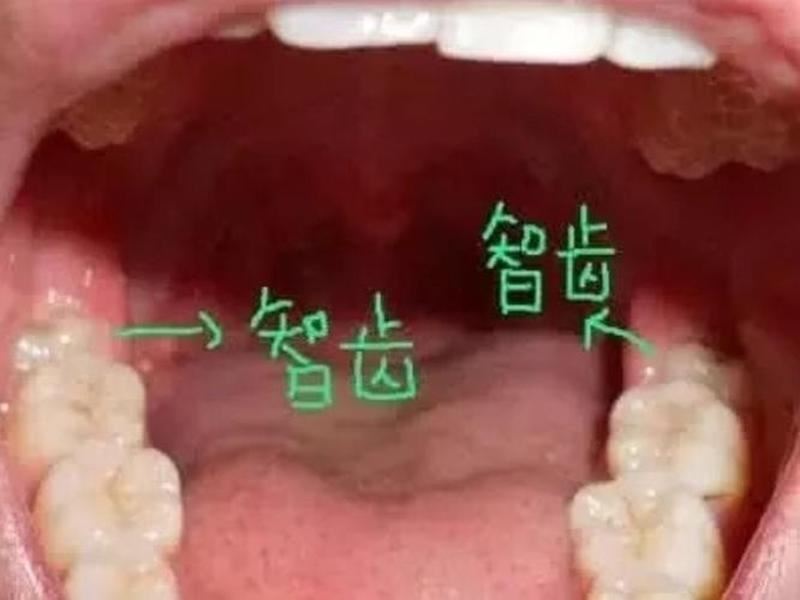 算命长智牙好吗？这些方法告诉你！