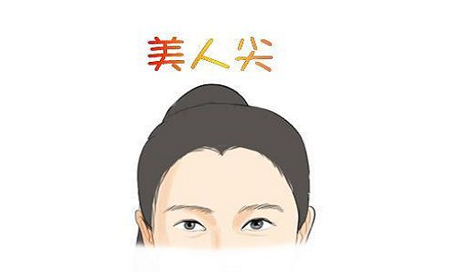 美人尖